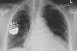 Health Canada issues cybersecurity guidance for medical devices Health Canada issues cybersecurity guidance for medical devices